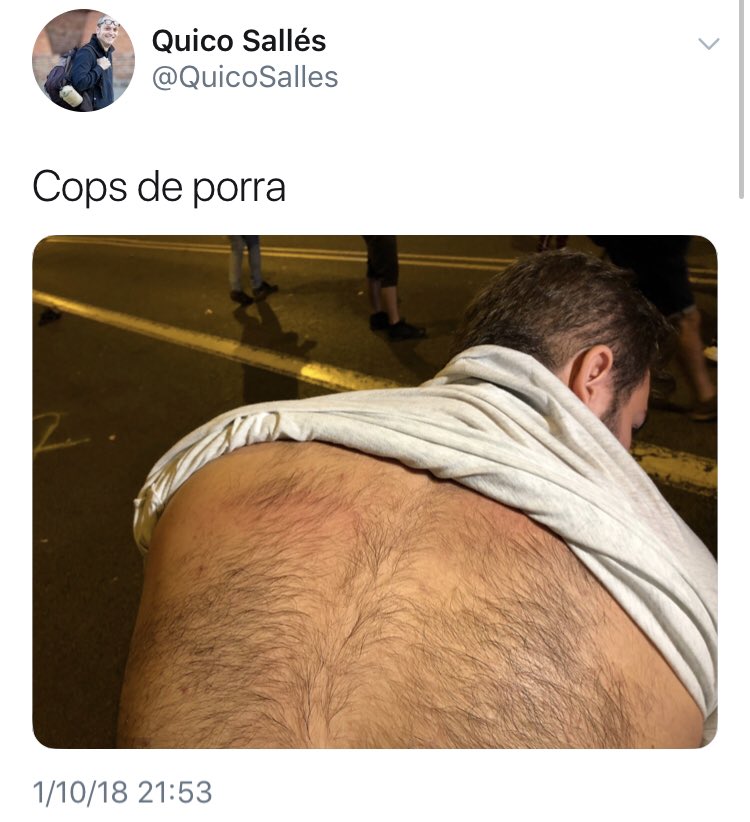 Nicotiana15's tweet photo. Nueva tradición separata: el caga-porra. Cada #1oct les encanta que les peguen con las porras.

Los #lazis querían una #TardorCalenta y...deseo concedido. 

Hoy van a domir calentitos. 

Cuantos heridos? Les han tocado las tetas?

#1OctFakeReferendum #1deOctubre #LaSilenciosaCat https://t.co/0tnoalbbBI
