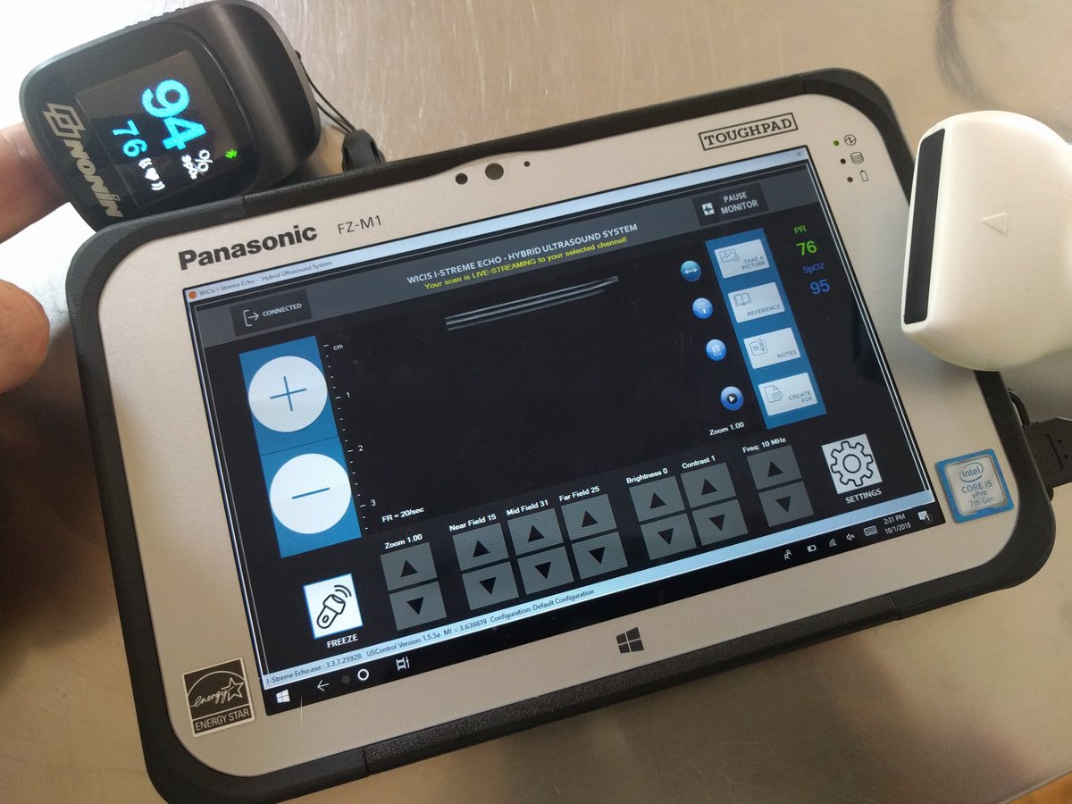 A rugged ultrasound that is battery operated, with vital signs, and that you can even carry in your backpack with live image streaming? #Military #Navy @TheTATRC #ultrasound @TechDataGov  @PanasonicUSA #Telemedicine #EHR #monitorshareprotect with WiCis