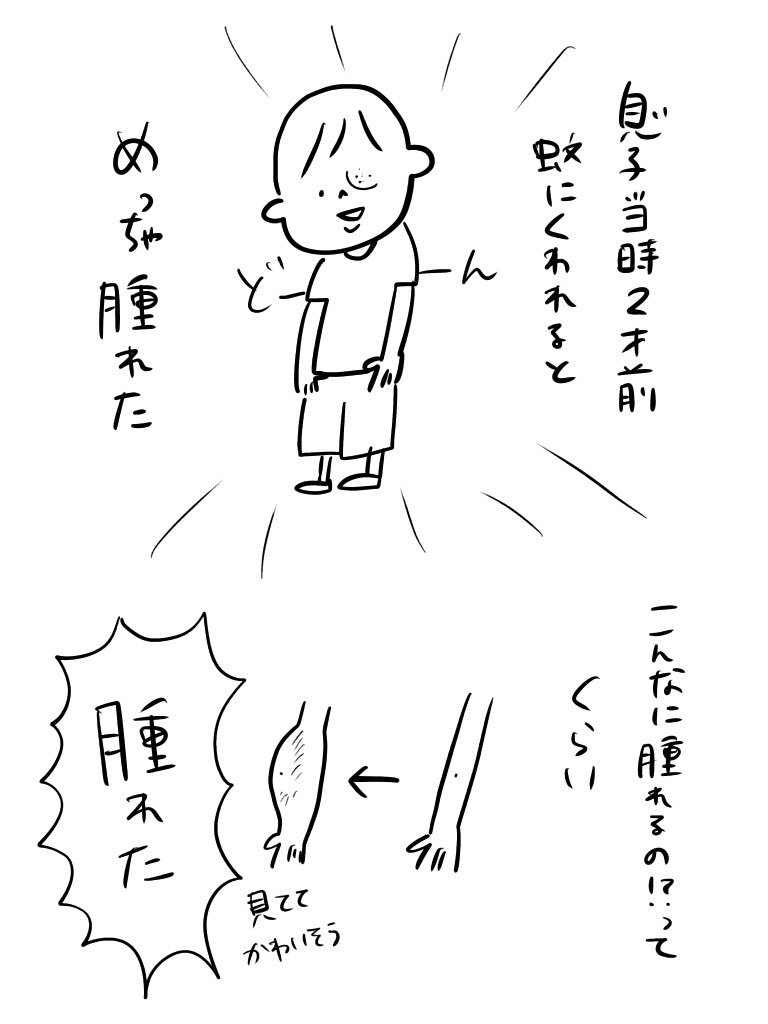 去年の夏に戦ってた話。今年は暑すぎて全然いなくてラッキーと思ってましたが、最近気温が下がったせいかまた出てきましたよね…蚊…。

息子がめっちゃ刺されやすくて困ってます。娘は全然なのに…?オススメの対策法あれば知りたいです。 