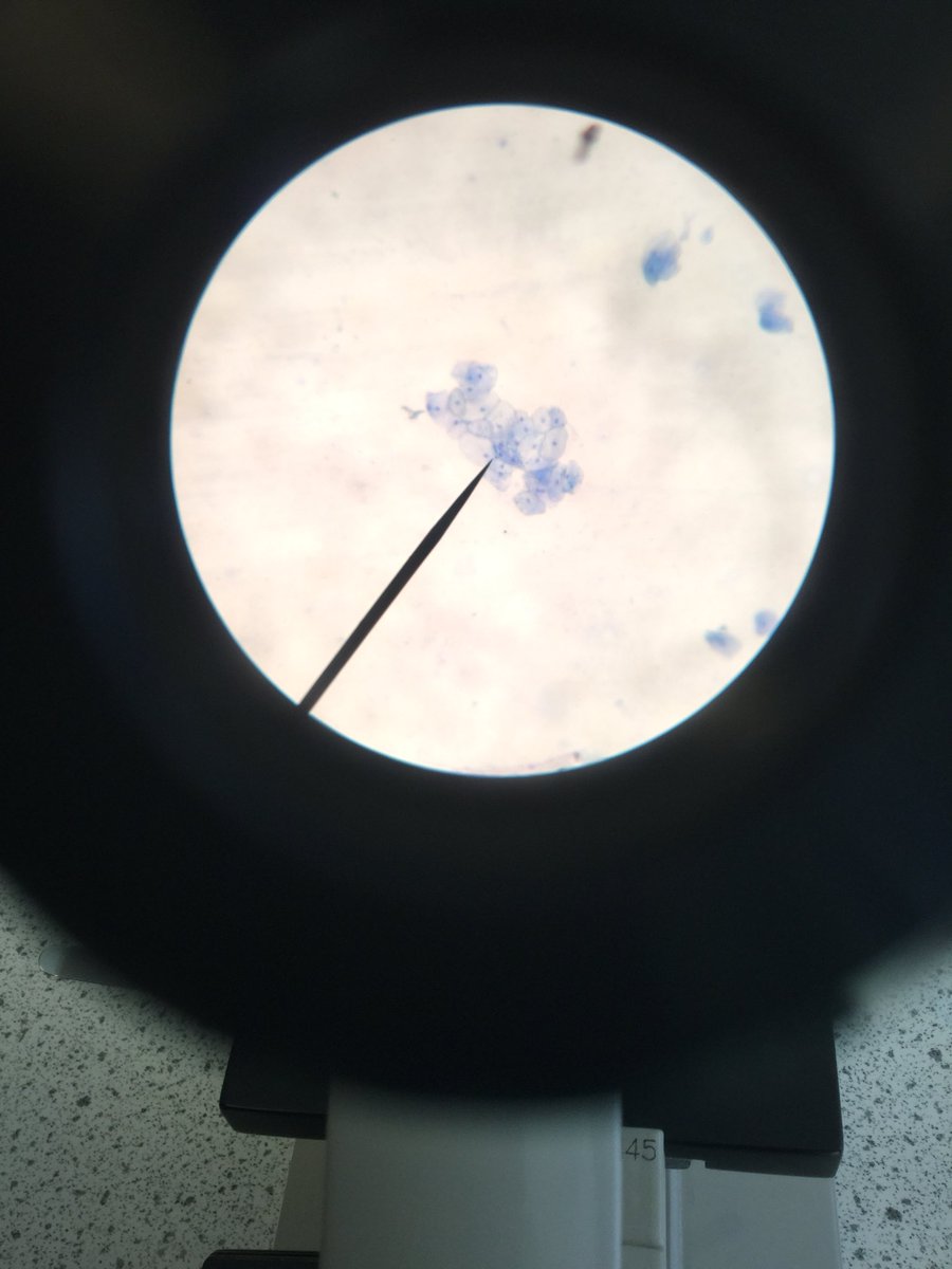 Science@BMS (@sciencebms) on Twitter photo Look how cool these #cheekcells are. Well done Jack in year 6 for having awesome cells. The true original #cellfie <a href="/Tes_Primary/">Tes_Primary</a> <a href="/ScienceSparks/">Science Sparks</a> <a href="/PrimaryScience/">PrimaryScience</a> <a href="/Birchensale/">Birchensale Middle</a> Look how cool these #cheekcells are. Well done Jack in year 6 for having awesome cells. The true original #cellfie <a href="/Tes_Primary/">Tes_Primary</a> <a href="/ScienceSparks/">Science Sparks</a> <a href="/PrimaryScience/">PrimaryScience</a> <a href="/Birchensale/">Birchensale Middle</a>