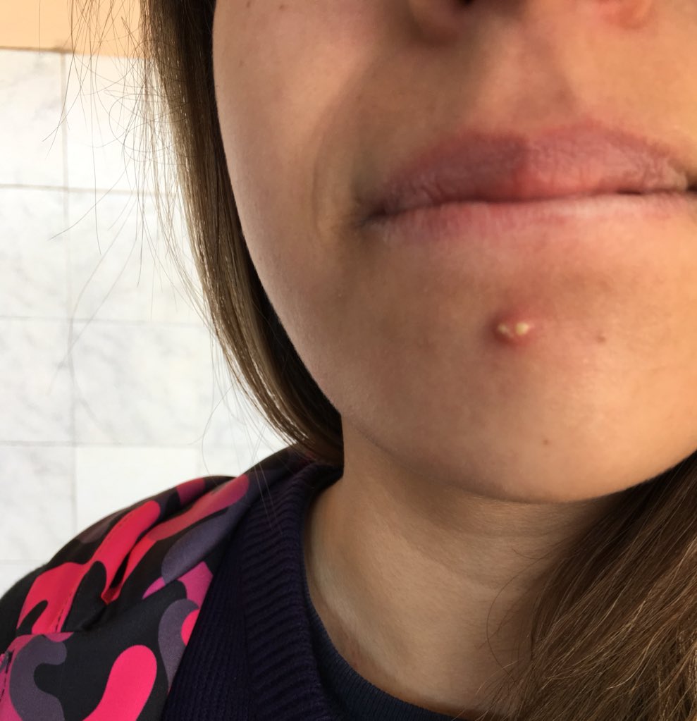 Rt o mañana te sale uno asi