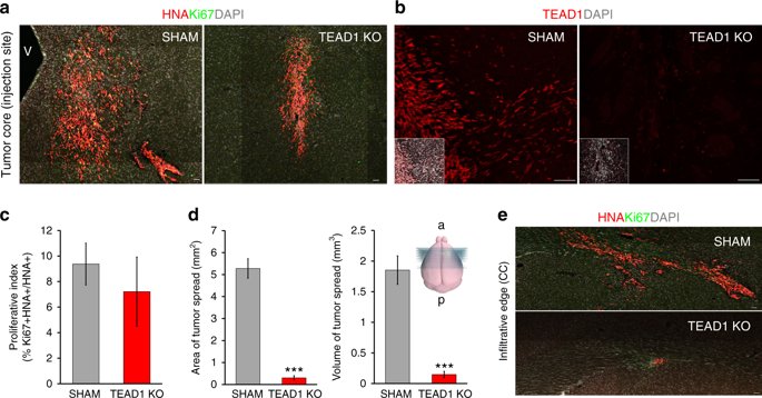 GIRCOR's tweet photo. #Glioblastome: une étude #invitro sur cellules de patients et #invivo sur modèle #souris a permis de découvrir que la protéine #TEAD1 régule la migration des cellules tumorales dans le #cerveau https://t.co/vCVwB57jED https://t.co/6tGH3MUhfD