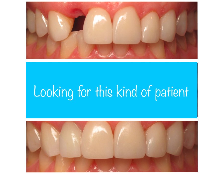 clau_claud18's tweet image. FREE!  FREE!  FREE! 👨🏻‍⚕️
Bring back your beautiful smile!

All procedures are FREE and will be done at NU College of Dentistry under the supervision of licensed dentists.

#fixedbridge #free #bringbackyourbeautifulsmile