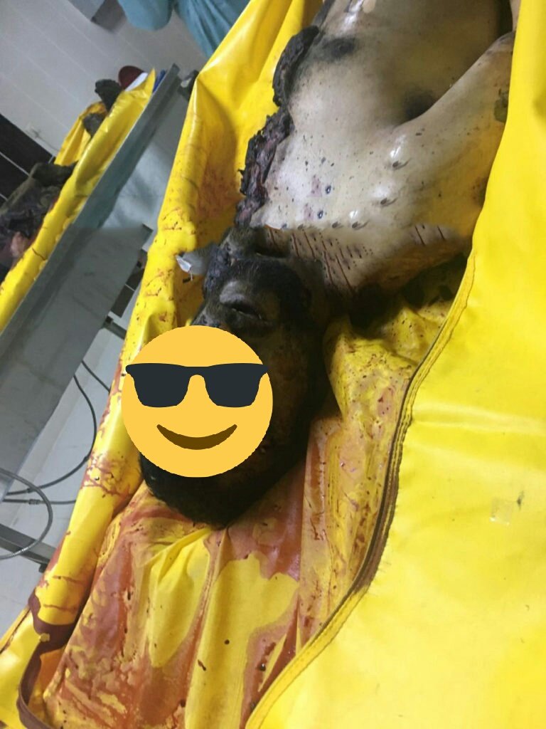 Özgürlük Dağlarda Gençler :) En Son Özgürlük Diyenlerin Son Hali ;) 

 #DemirtaşaÖzgürlükİstiyoruz