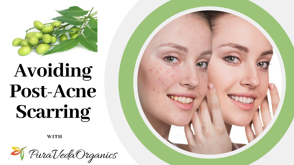 PVOrganics's tweet photo. If episodic #AcneBreakouts are nothing new to you, chances are these blemishes may also leave embarrassing #postacneredness and even permanent #AcneScars! Learn More to get rid of them: https://t.co/j1VEavHKKs
#OrganicSkincare #NotTestedonAnimals #NonToxic #Detoxification https://t.co/zLMoCx9KTm