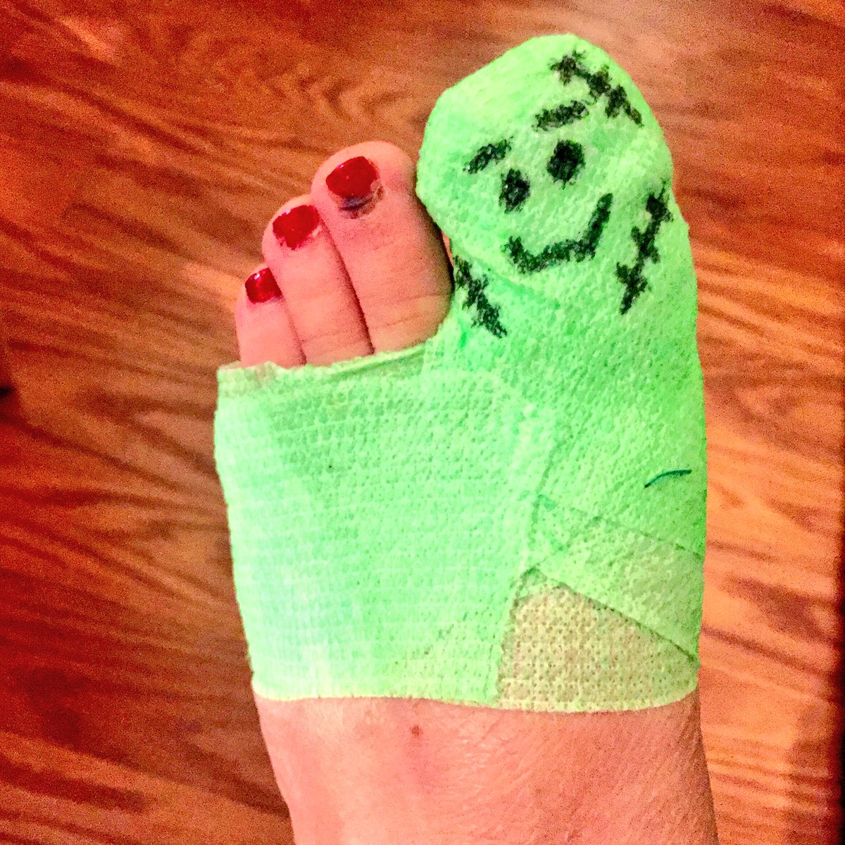 MrsABurkitt's tweet photo. No offense, FrankenToe, but I hope youโre gone from my life tomorrow๐๐ป๐!! #stitchesout #hopefully https://t.co/KQQZHej8Hi