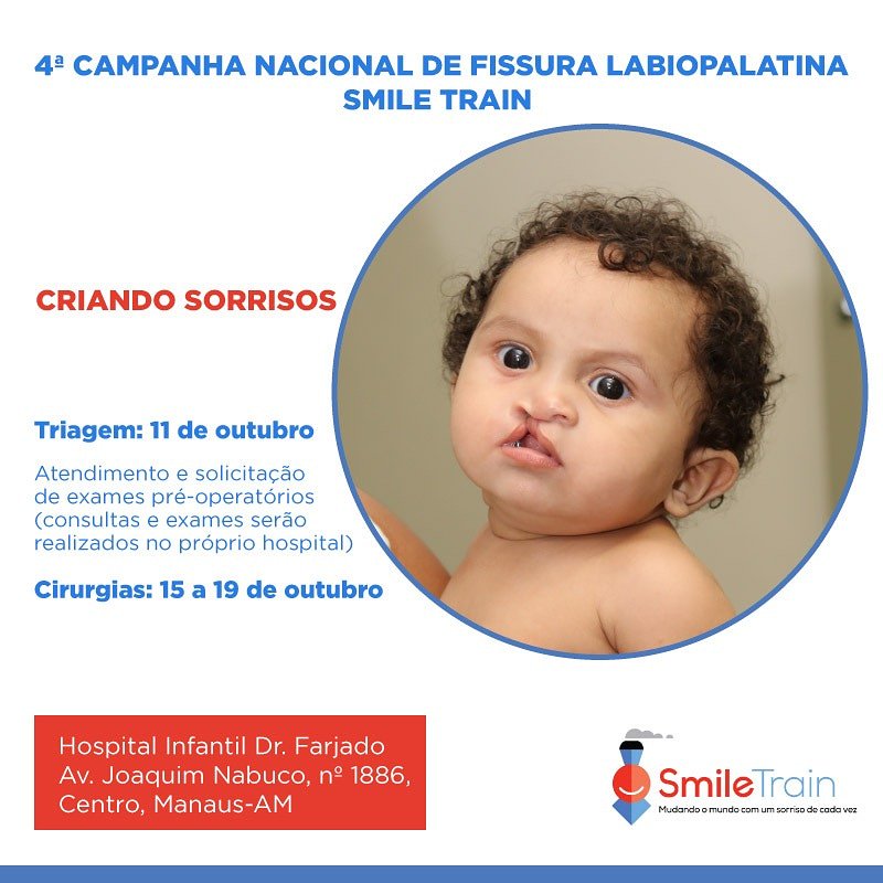 Companhia nacional de fissura labiopalatina  . Um sorriso não tem preço !!! 👦👶👧😁💕
Apoio 
#smile #train
 #susam 
#hospitaldoutorfajardo 
#secretariadesaude