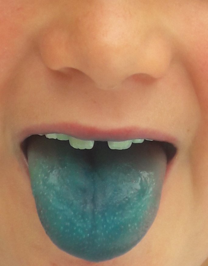 andreanhj's tweet image. Evidence! My beautiful blue tongued child has definitely not just eaten a sweet  #GrossSweets #GapTooth