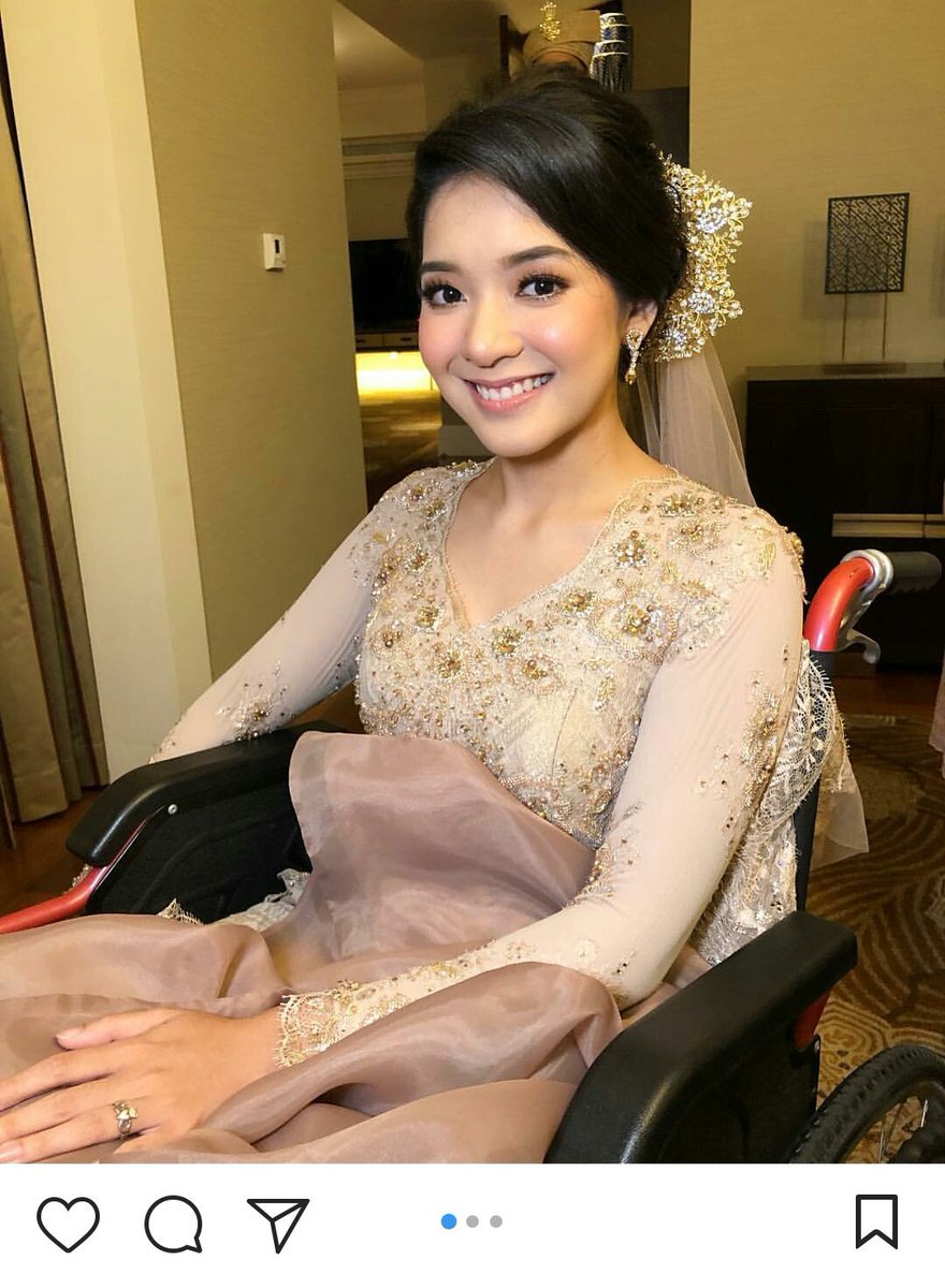 rzfkr's tweet photo. She's not able to walk but, tapi aku rasa dia ni cantik gila do. https://t.co/BfqJRGIsZy
