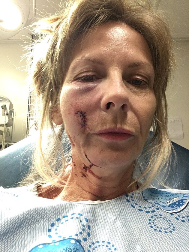 Ottawa cyclist at a loss for how to fix unsafe roads for riders: bit.ly/2NjcD5R #ottnews https://t.co/2O63eHuO8B