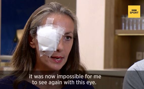 The #RyderCup spectator who was left blinded in one eye says she could have died.
More: https://bbc.in/2OxpztA
