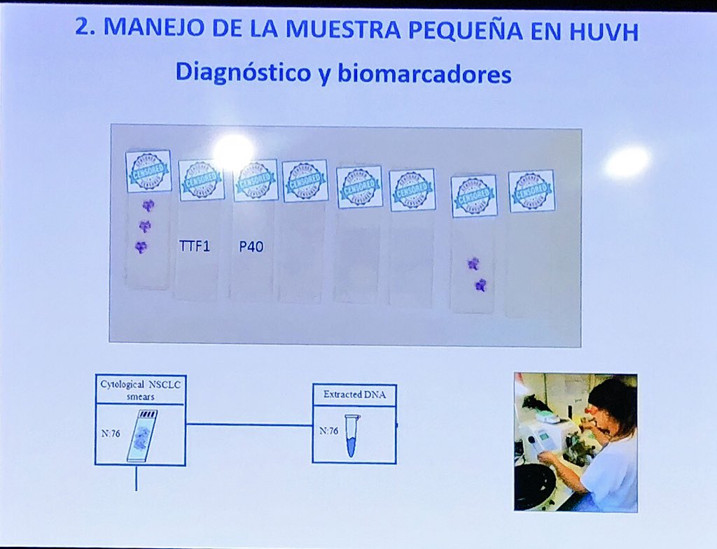 lara_pijuan's tweet image. .@SansanoValero como buena patóloga pulmonar nos explica trucos para mimar las biopsias tan pequeñas y valiosas 🙌🏻 Tips to make a plan and save tissue for molecular tests #ROS1 #CodingLungCancer #whypathologistmatter #pulmpath