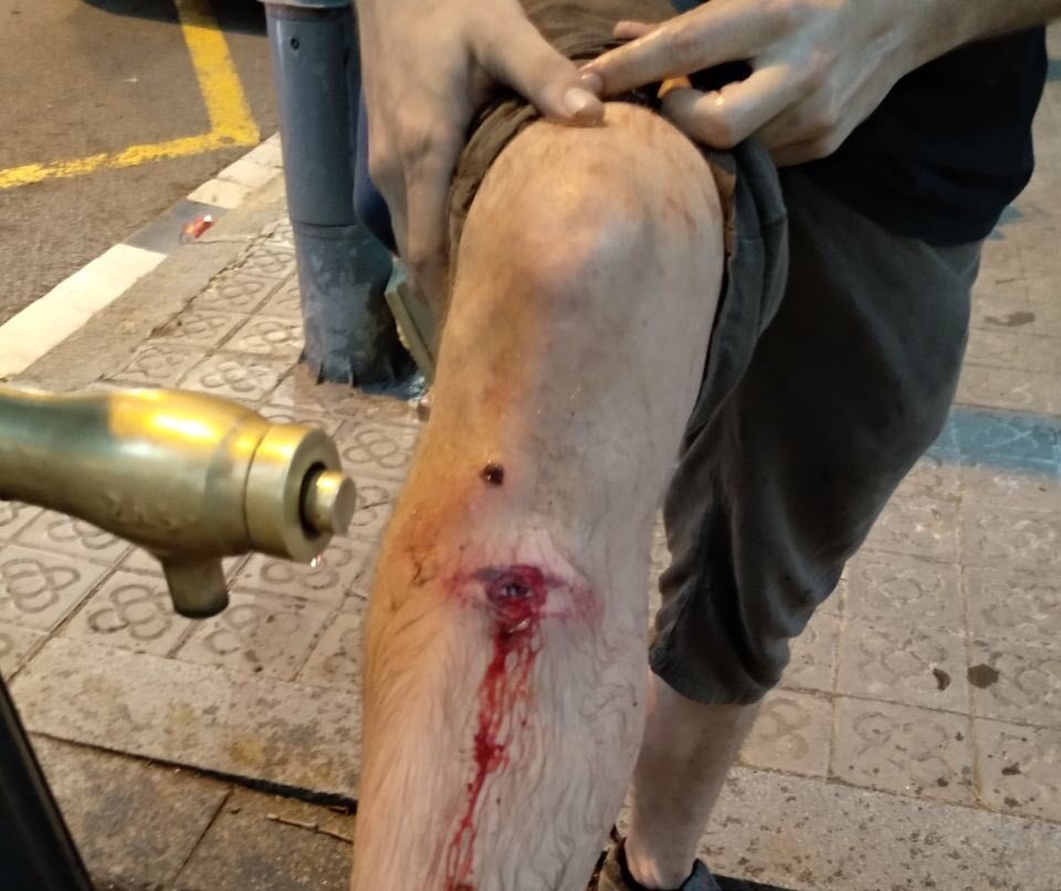 cupnacional's tweet photo. Bona nit @MiquelBuch
Un cop més aquesta és la resposta dels mossos a manifestants que defensen els carrers de la impunitat i la violència del feixisme.
I no pensem normalitzar-ho.
#BuchDimissió https://t.co/uGjJcRrmLo