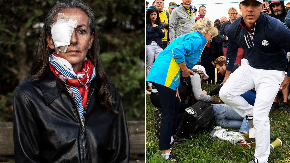Woman whose eyeball 'exploded' after golf ball hit her speaks out