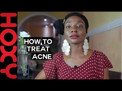 Acne Treatment at Home - hoxymagazine.com/index.php/2018…
