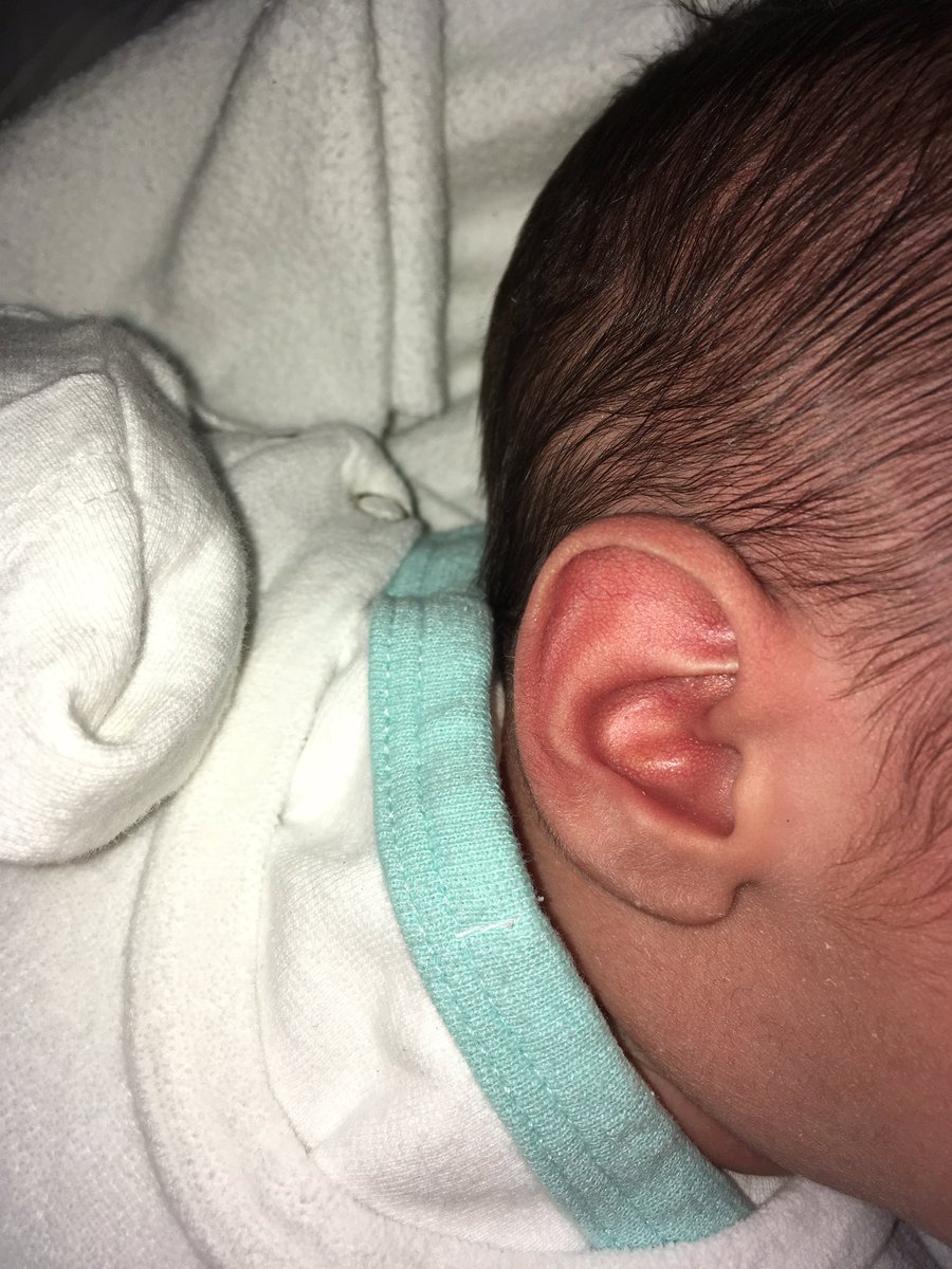 Stupsotta's tweet photo. Hallo Welt, ich bin da! https://t.co/vf2LoyfOwu