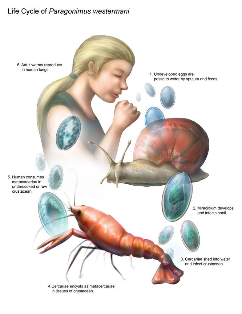غيداء طلال بصفر🇸🇦 on Twitter "1Trematodes 2Lung fluke (Paragonimus