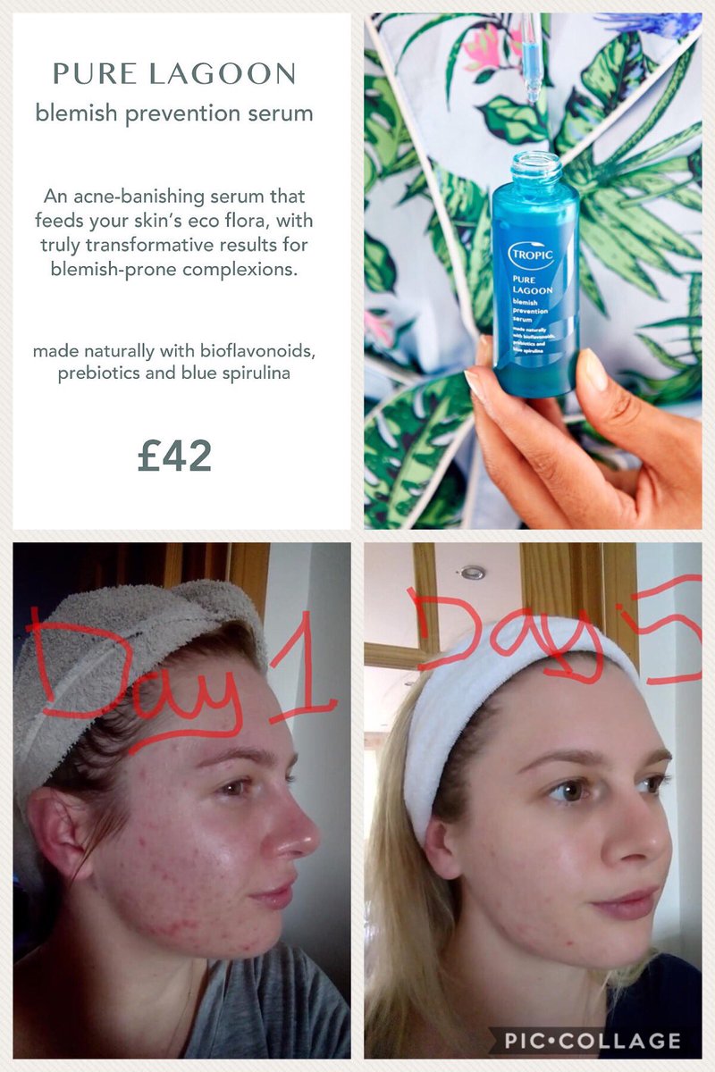 Fresh - Matlock tweet media