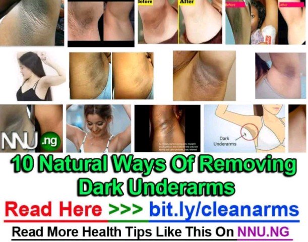 Sparkle21364993's tweet photo. #NNU_Income - 10 Natural Ways Of Removing Dark Underarms - Read Here >>> https://t.co/QhuMsumNw7
#HealthyLiving 
#fitness 
#wellness 
#beauty https://t.co/BEGVGsNtf9