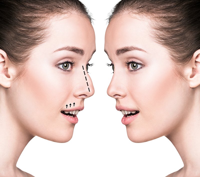 PlasticMeet's tweet photo. More
#Share your #knowledge by #submiiting #Abstract on #Nose surgery https://t.co/kkouchNdqc 
#Reconstructive #Aesthetic 
#Plastic_Surgery2019
For abstract submission visit: …https://t.co/gPKWxB6OiZ https://t.co/8Su4jYqJft