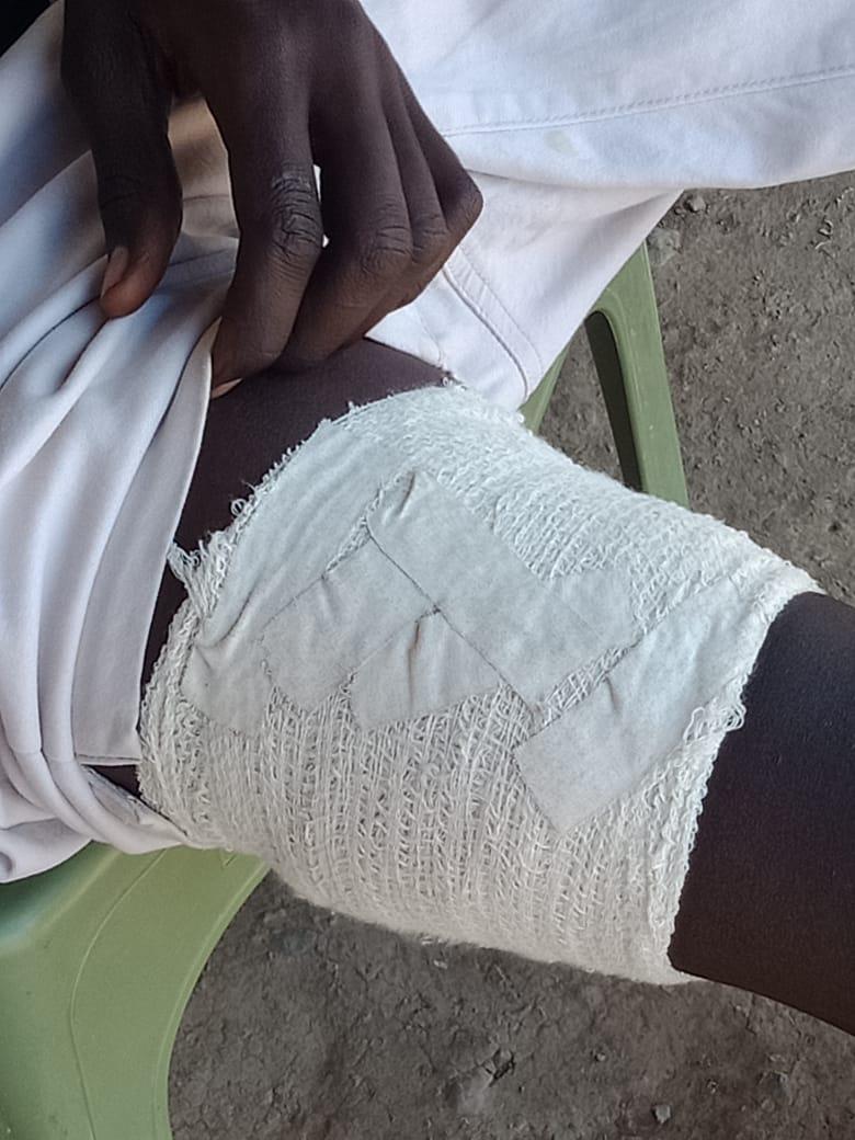 etelej_korea's tweet photo. Branson L Ejore a form 3 student from Kapedo mixed secondary nursing gun wounds of Pokot terrorists bullets sprayed in their classes yesterday!
Sad that no media house highlights such impunity!
#Turkanalivesmatter! 
@JimmyLoree 
@JamesLokwale https://t.co/lrc7iqltZe