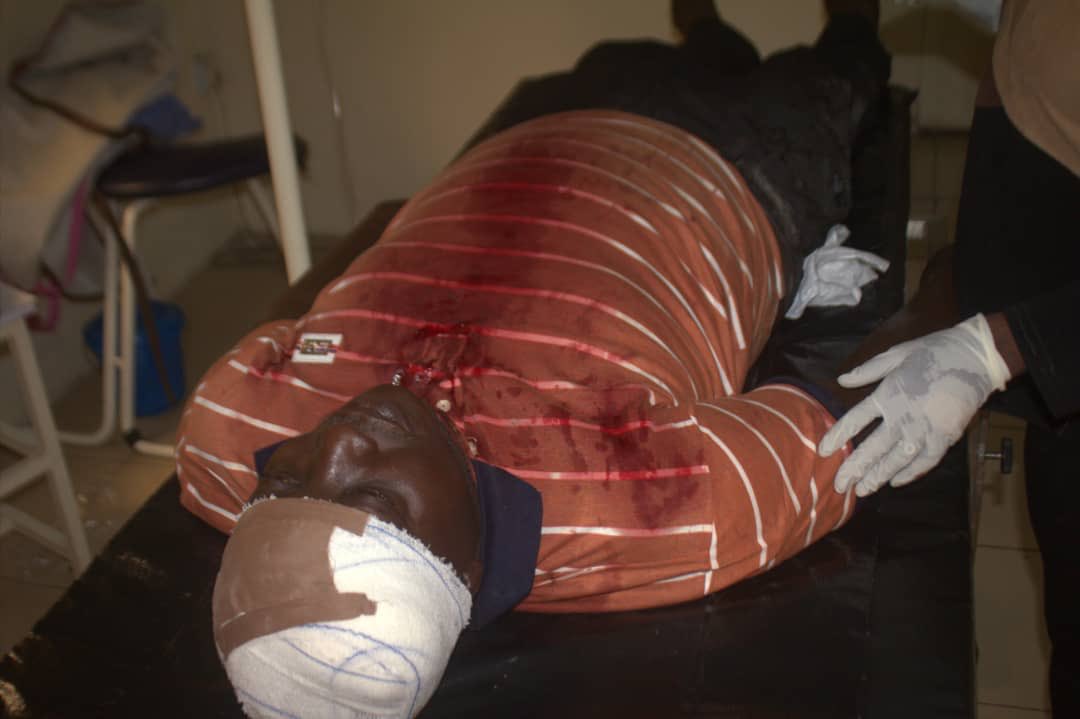 dayobush's tweet photo. Earlier today, during the #APCLagosPrimaries Hon. Ibrahim Mustapha was attacked by hoodlums loyal to @HonOsinowo and Hon.@RotimiAgunsoye at Ward C, Anothony Village. As leaders,we must shun all acts of violence and as citizens we must condemn such acts of political desperation. https://t.co/TRBWS7ZK16