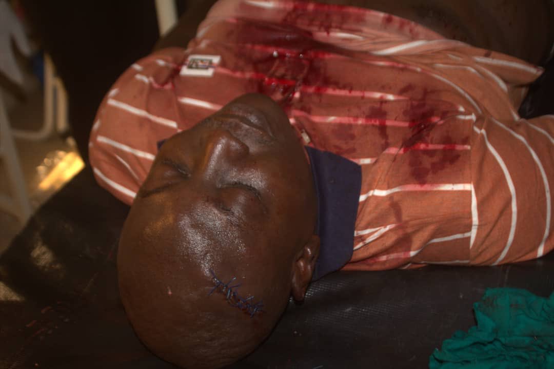 dayobush's tweet photo. Earlier today, during the #APCLagosPrimaries Hon. Ibrahim Mustapha was attacked by hoodlums loyal to @HonOsinowo and Hon.@RotimiAgunsoye at Ward C, Anothony Village. As leaders,we must shun all acts of violence and as citizens we must condemn such acts of political desperation. https://t.co/TRBWS7ZK16