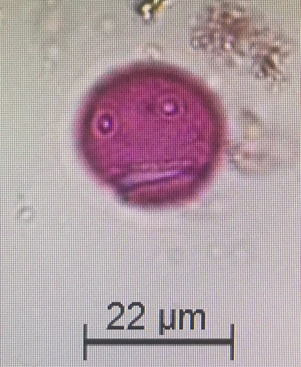 PalyJen's tweet photo. When your #pollen grain matches your mental state. https://t.co/9Fk56HKk7Q