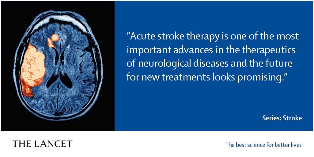 TheLancet's tweet photo. #Stroke is the second leading cause of death globally, resulting in over 5 million deaths every year. New 3-part Series discusses recent advances in diagnosis and management of two major stroke subtypes and strategies to reduce the risk of stroke. https://t.co/u0vRnvLh0P https://t.co/JVTXzN3nYl