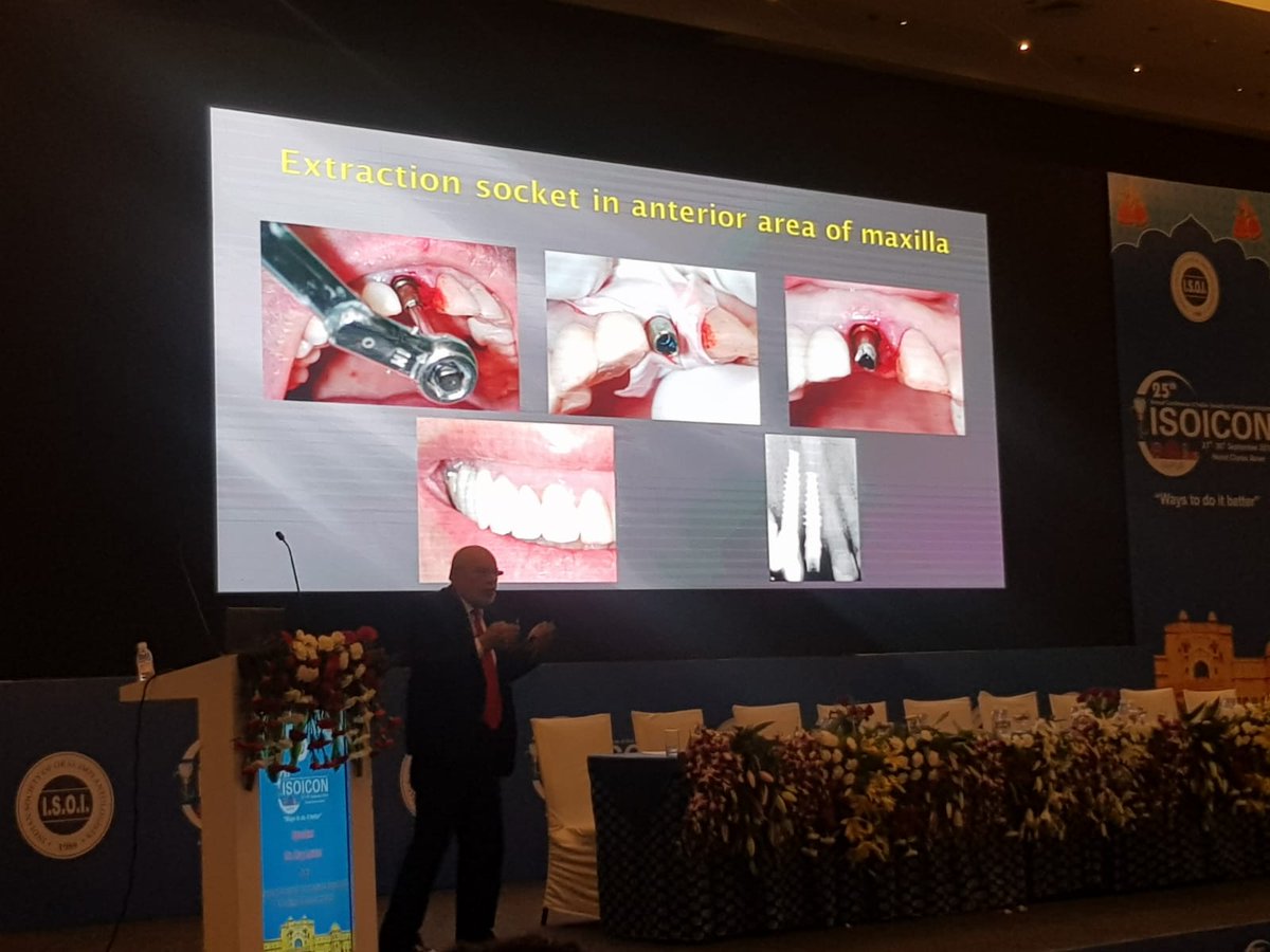 CortexIndia's tweet image. Had an Amazing &amp;amp; a Successful #ISOI2018 in Jaipur.

Thanks to all the Doctors who visited #Cortex India team and learned about Cortex innovative dental Implants.

Also, would to thanks for attending Dr. #Zvi #Laster's lecture and Hands on session.

It was a great show.