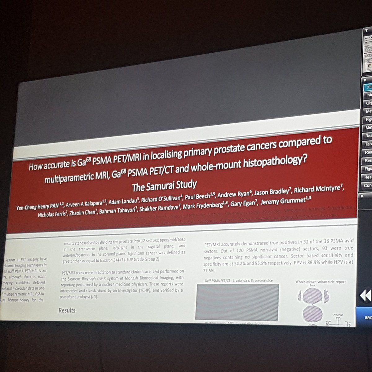 DrTNzenza's tweet photo. @Henry_YC_Pan presenting his "Samurai study" @AusYURO #SIU2U #SIU2018 @ArveenKalapara https://t.co/cDsmG394fn