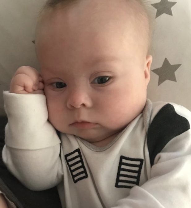 Three weeks today this little fighter goes into Great Ormond Street for open heart surgery - petrified isn't the word #Trisomy21 #PositiveAboutDownsSyndrome #AlbieJ #LittleFighter