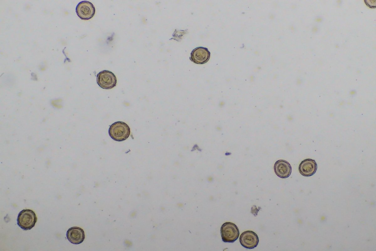 神戸大学大学院 保健学研究科 寄生虫学 Na Twitteru 縮小条虫の虫卵の写真です 丸いのが虫卵 左側は薄層塗抹法 右側は飽和食塩水浮遊法 神戸大学大学院 保健学研究科 寄生虫学 Na Twitteru 縮小条虫の虫卵の写真です 丸いのが虫卵 左側は薄層塗抹法 右側は飽和食塩水浮遊法