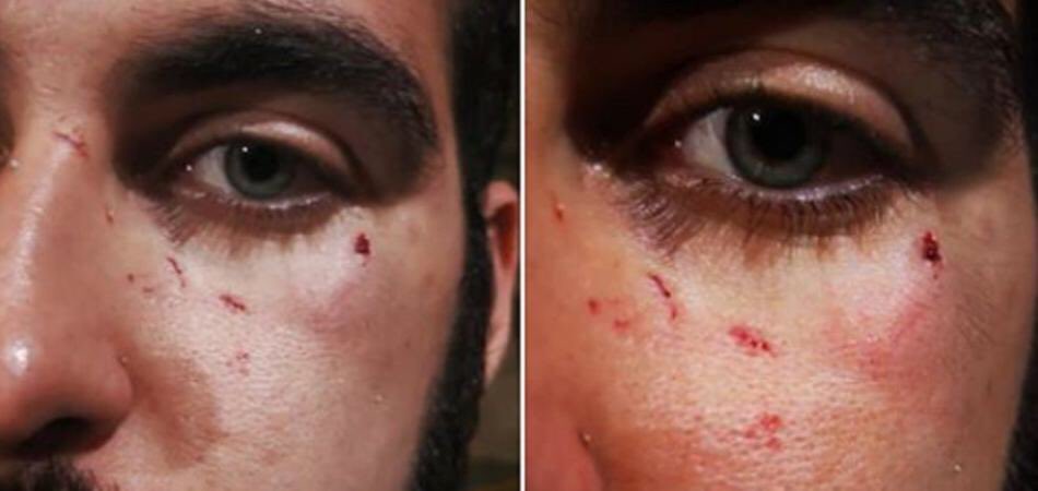 radio__zek's tweet photo. Stavolta è successo a Christian e Marco. Picchiati e insultati solo perché gay, in strada, a #Pisa. «Si sono divertiti a sputarci in faccia e dirci che gli facevamo schifo. Questa è l’Italia». L’Italia fomentata da odio e #omofobia https://t.co/hkqvxz46Eh
