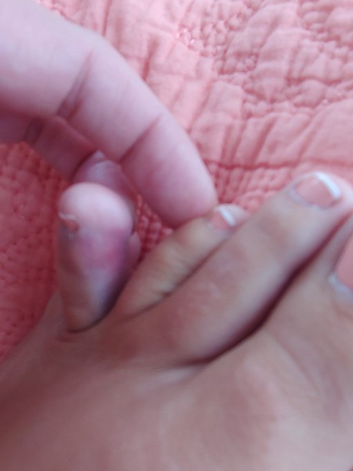 Umm.. I think I broke my toe🙁 https://t.co/7PGmhNMcbu<a href="/tag/femdom"class="tags"><span>#femdom</span></a><a href="/tag/whipabitch"class="tags"><span>#whipabitch</span></a>