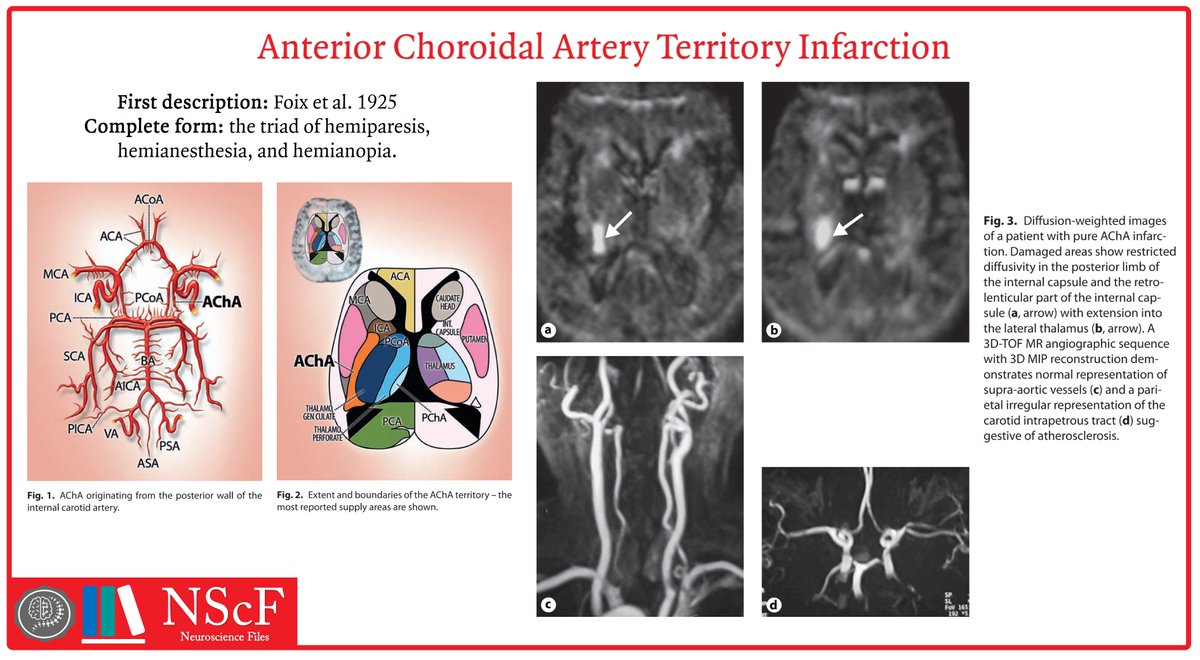 9 The Anterior Choroidal Artery Radiology Key vrogue.co