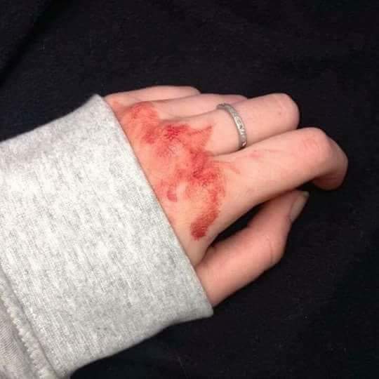 pozzpy's tweet photo. That we hurt ourselves because of broken heart. I can see that stupid. You're not here, you're not.

การที่เราทำร้ายตัวเองเพราะอกหัก อาจจะดูว่าโง่ แต่คุณไม่ได้มาอยู่ในจุดนี้คุณไม่ใจเข้าหรอก
#ยืมเมจforsex 
#ยืมเมจfortalk 
#โรคซึมเศร้า https://t.co/udKiFH6bBj
