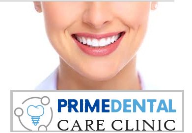 Prime #dentalcareclinic offers a range of services for patients who need some better solution for teeth whitening. Know how it works here bit.ly/2O6YaPD