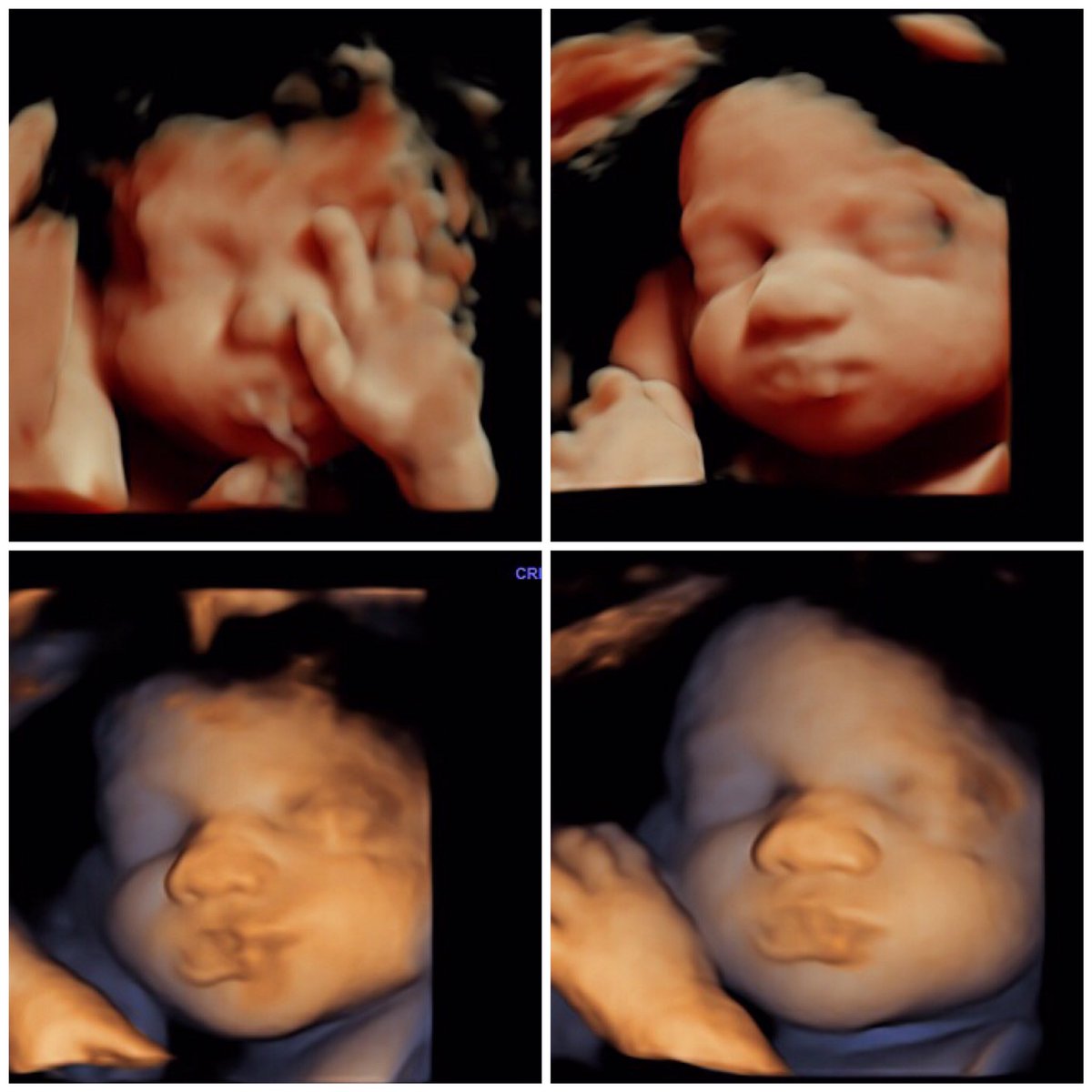 baby_dimensions's tweet photo. https://t.co/2BZEVShPvB