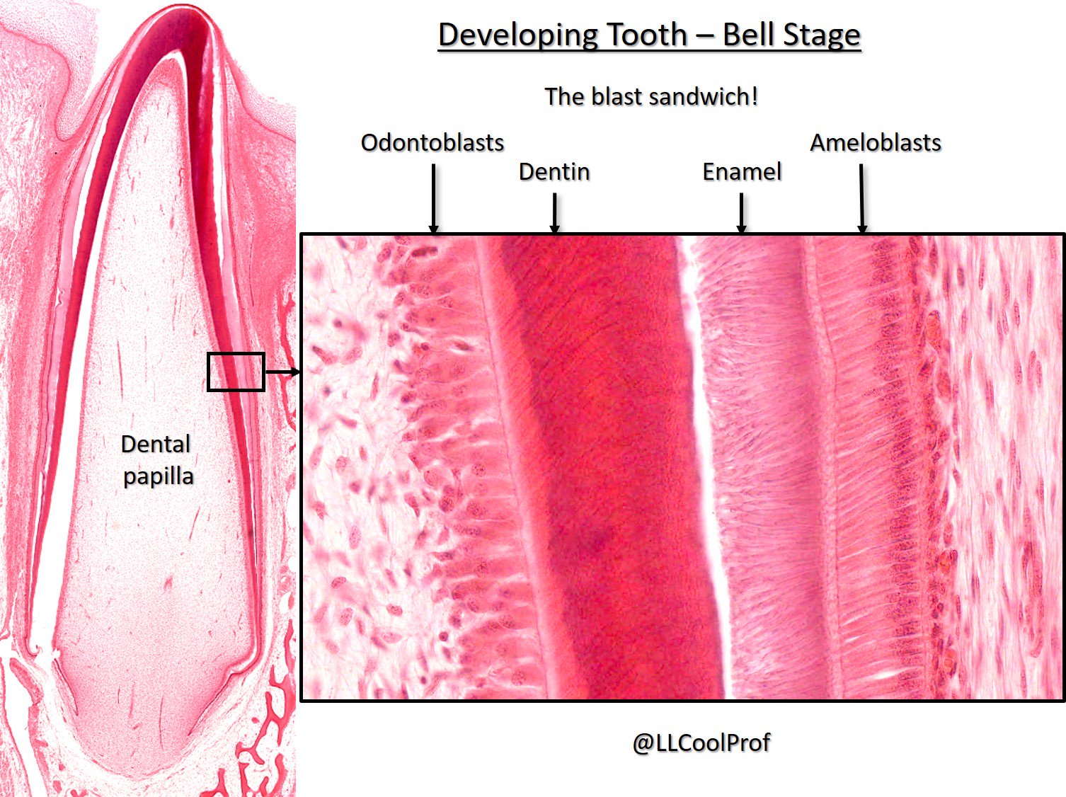 Dr. Lisa Lee on Twitter "T is for Teeth! Histological marvels of