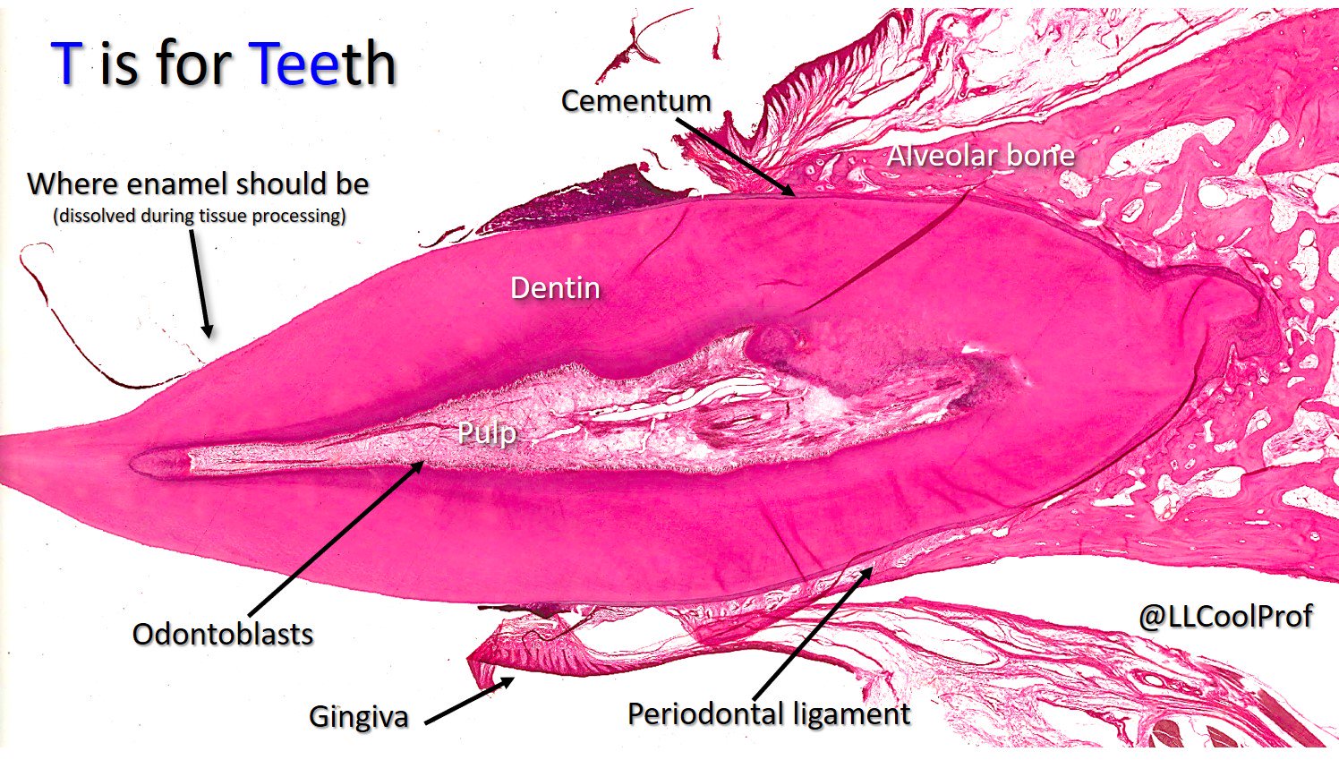 Dr. Lisa Lee on Twitter "T is for Teeth! Histological marvels of