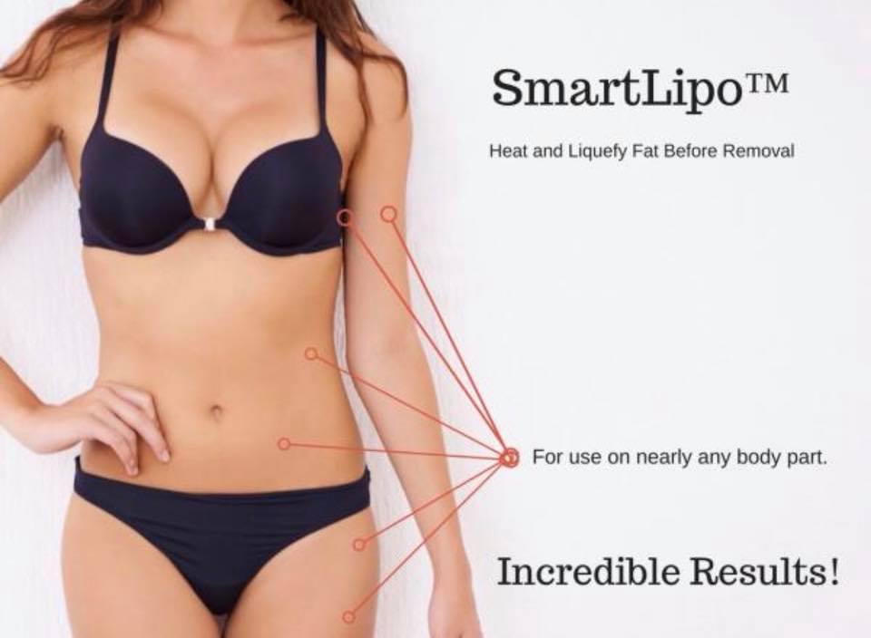 #SmartLipo is a specialized form of #liposuction that improves elasticity &amp; overall tightening of the skin. A laser fiber that generates heat is placed into a very small cannula that helps enhance collagen and melts pockets of fat to help improve the overall contour of the body.