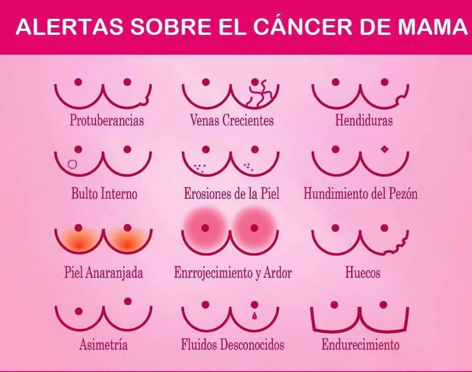 RaquelEcenarro's tweet photo. Muy importante!!!

Alertas sobre el cáncer de mama 

#DíaMundialDelCáncerDeMama https://t.co/B6GrQJjC1E