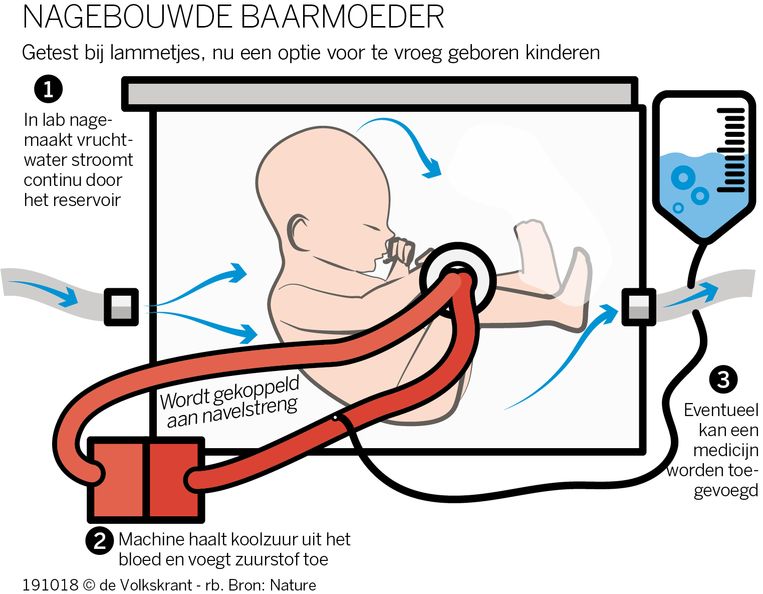 TMI_Interim's tweet photo. Wordt dit de kraamkamer van de toekomst? Amerikaanse kinderartsen slaagden erin acht te vroeg geboren lammetjes in een kunstbaarmoeder in leven te houden. "Dit succes maakt de kunstbaarmoeder opeens ook voor de mens haalbaar," aldus gynaecoloog Guid Oei. https://t.co/xUHK9l0tes https://t.co/1WFz9qen3S