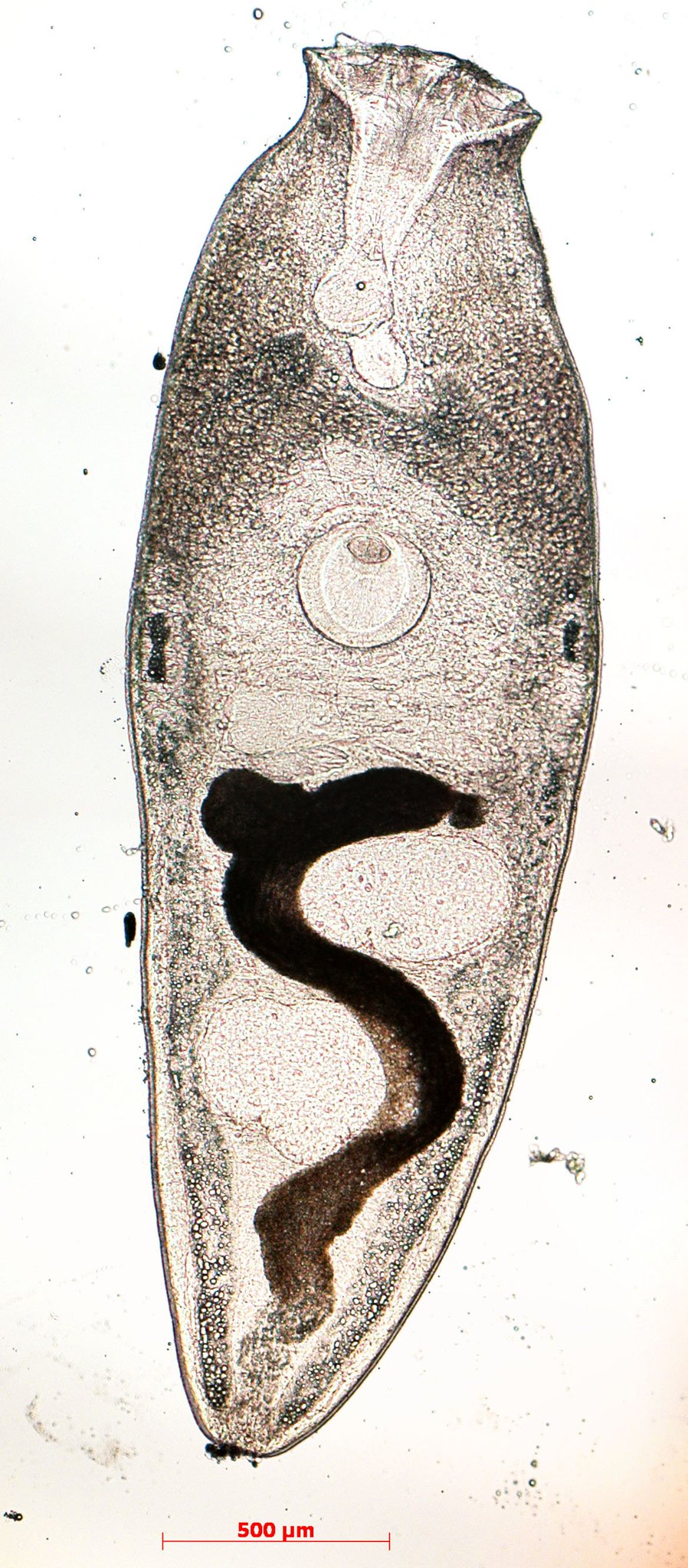 旭川医大寄生虫学講座 この黒い粒の中に住んでいるのは Liliatrema属吸虫の幼生です 一般的な口吸盤と異なり ラッパみたいな形をしているのが特徴 ちなみにヒトが食べても問題ありません
