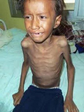 charlieth2's tweet photo. DIOS MIO AYUDANOS ¿Por qué los más inocentes que son nuestros niños  venezolanos, están Muriendo de desnutrición, abandono y sufrimiento y nadie hace nada, HEY hermanos  son los hijos de Venezuela nuestra Venezuela tu Venezuela paremos esto nos estamos matando y no se dan cuenta https://t.co/KhDNJ6vine