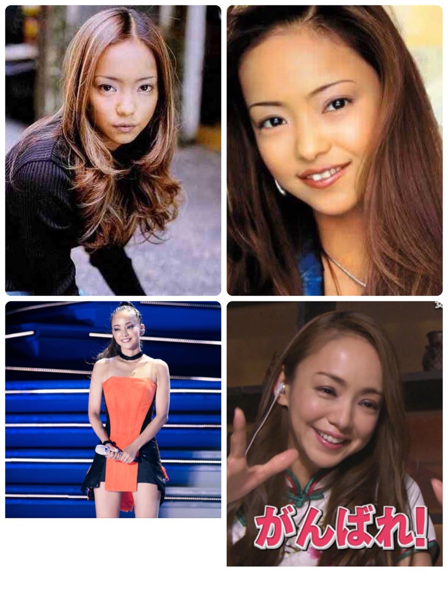 アネモネ 年齢差の少ない2人の老け方の違いについて高須先生の納得のご意見 安室奈美恵 色黒 タヌキ顔 ベビーフェイス ホリ深く ない あゆ 相対的なドールフェイス 色白 ホリ深い あゆは痩せたらかわいいのでは と思っていたけど シワを隠すために