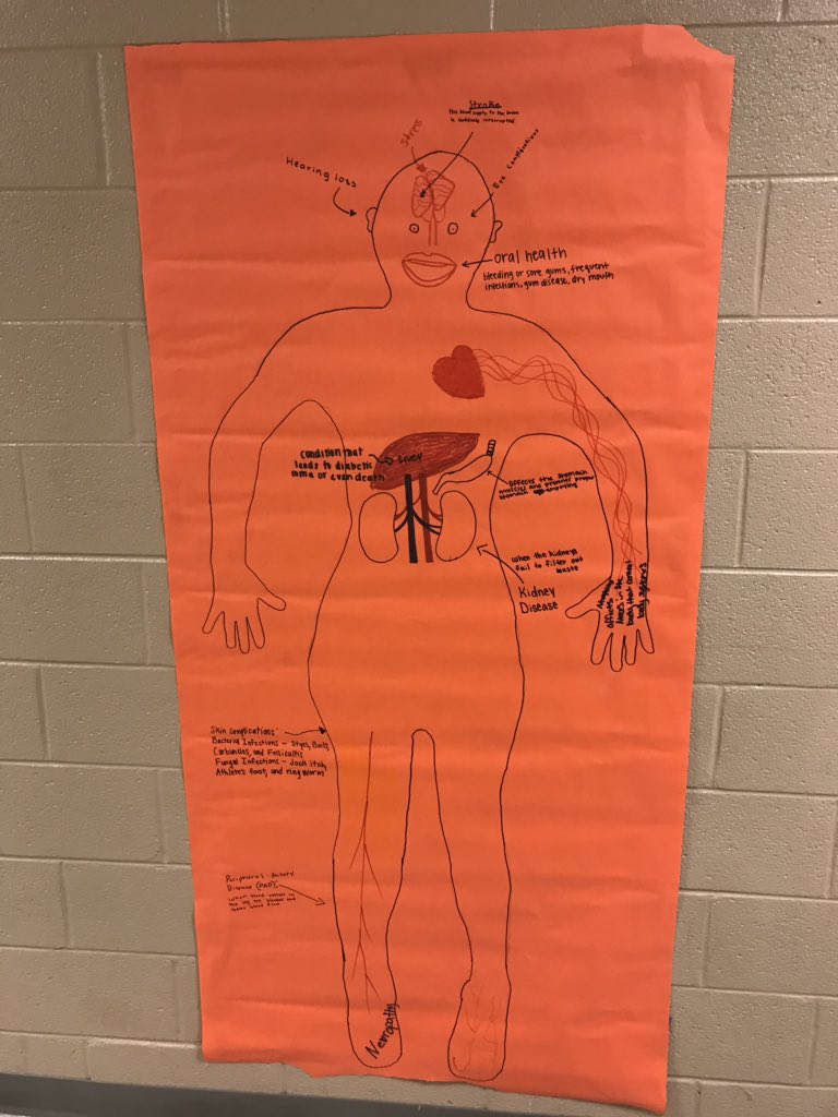 BiomedSci_JCHS's tweet photo. Principles of Biomedical Science studying and diagramming the complications of Diabetes. Not done yet but a good start. #jchslife #PLTW #RSS_CTE https://t.co/9S1eOBDFAH