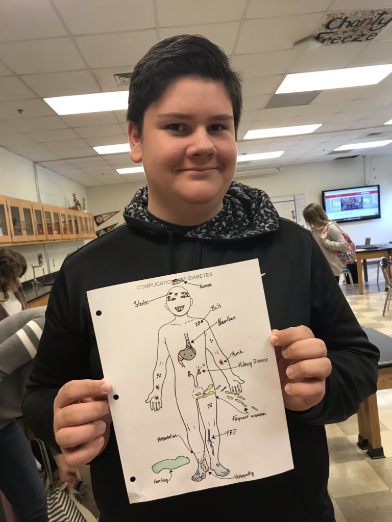 BiomedSci_JCHS's tweet photo. Principles of Biomedical Science studying and diagramming the complications of Diabetes. Not done yet but a good start. #jchslife #PLTW #RSS_CTE https://t.co/9S1eOBDFAH