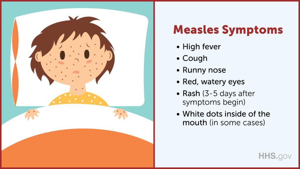 Measles graphic